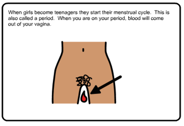 Learning about Menstruation for girls with Developmental